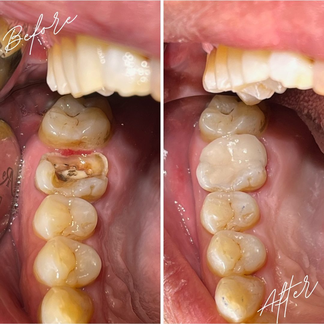 Before After Feed